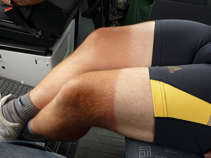 Die Beine zeugen von wettertechnisch besseren Zeiten