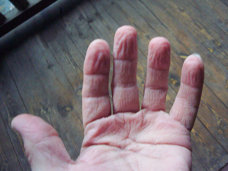 Die H&auml;nde sind von der N&auml;sse ganz verschrumpelt