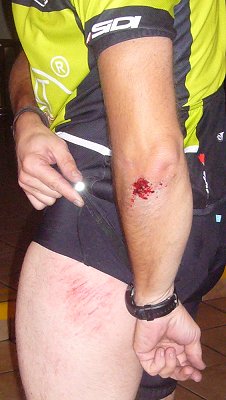 Nach dem Sturz :-(